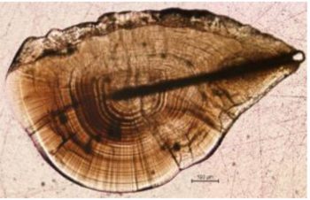 Otolithes 